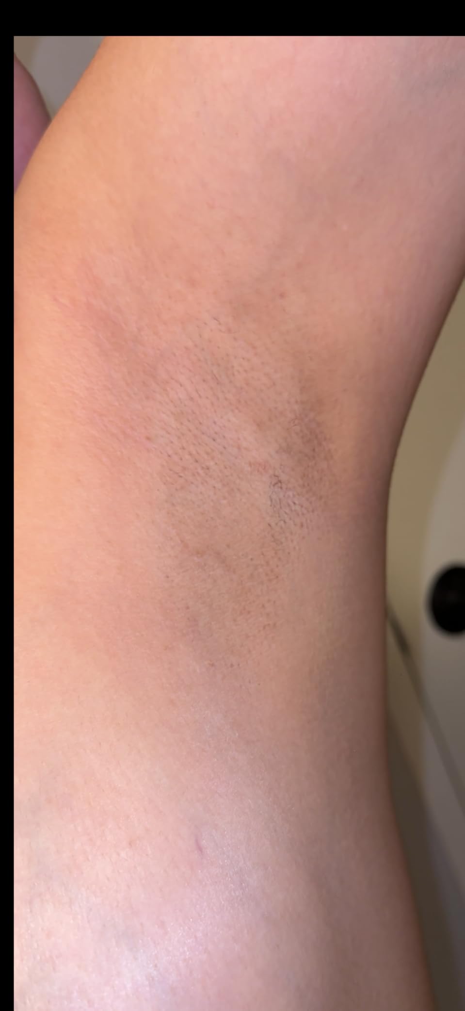 Blex Laser Hair Removal for Women and Men, IPL Hair Removal Device Effective in 2 Weeks, with Ultra-Fast 0.2s Light Emission, Comfortable and Painless, Black customer photo 2
